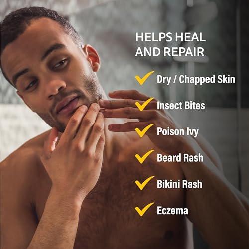 A+D Medicated Rash Ointment 1,5 oz – Lindert Hautausschlag & gereizte Haut durch Giftefeu, Ekzeme, Bart, Bikini, trockene Haut, rissige Haut, Insektenstiche – mit kolloidalem Hafermehl
