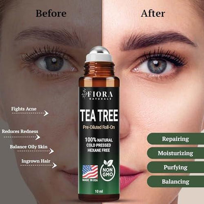 Fiora Naturals Teebaumöl Roll-On – 100% natürliches ätherisches Teebaumöl für Haut, Gesicht, Akne, Nägel, Nagelhaut, Kopfhaut & Aromatherapie-Wohlbefinden