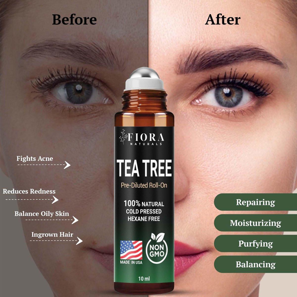 Fiora Naturals Teebaumöl Roll-On – 100% natürliches ätherisches Teebaumöl für Haut, Gesicht, Akne, Nägel, Nagelhaut, Kopfhaut & Aromatherapie-Wohlbefinden
