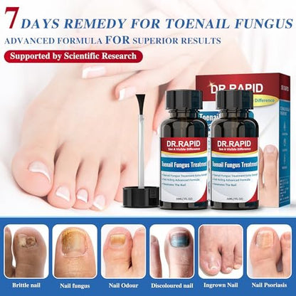 DR.RAPID Nagelpilz Behandlung Extra Stark – Effektive antimykotische Nagelreparatur mit Teebaumöl, schnelle Wirkung bei beschädigten Nägeln & eingewachsenen Zehennägeln – 60 ml (2 x 30 ml)