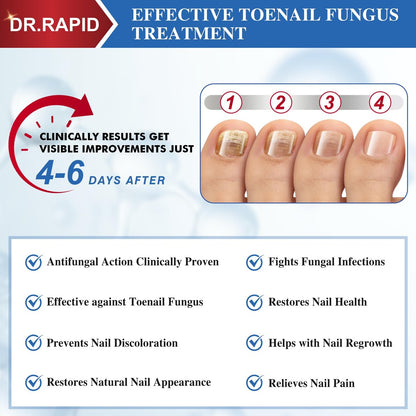 DR.RAPID Nagelpilz Behandlung Extra Stark – Effektive antimykotische Nagelreparatur mit Teebaumöl, schnelle Wirkung bei beschädigten Nägeln & eingewachsenen Zehennägeln – 60 ml (2 x 30 ml)