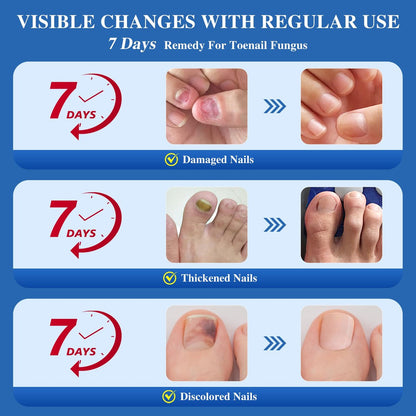 DR.RAPID Nagelpilz Behandlung Extra Stark – Effektive antimykotische Nagelreparatur mit Teebaumöl, schnelle Wirkung bei beschädigten Nägeln & eingewachsenen Zehennägeln – 60 ml (2 x 30 ml)