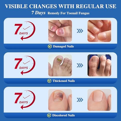 DR.RAPID Nagelpilz Behandlung Extra Stark – Effektive antimykotische Nagelreparatur mit Teebaumöl, schnelle Wirkung bei beschädigten Nägeln & eingewachsenen Zehennägeln – 60 ml (2 x 30 ml)