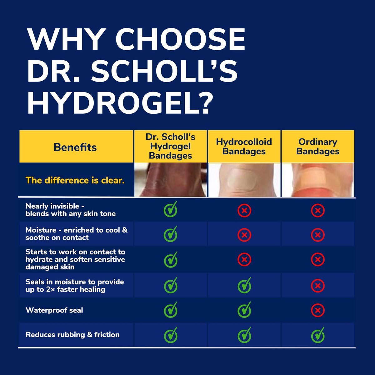 Dr. Scholl’s Blister-Schmerzlinderung Komplettset, 12 Stück – Die einzige Blasenbehandlung mit aktivem Schmerzmittel, Versiegelungs- und Heilpflaster mit Hydrogel-Technologie, Blasenpflaster, 4% Lidocain zur Betäubung von Schmerzen