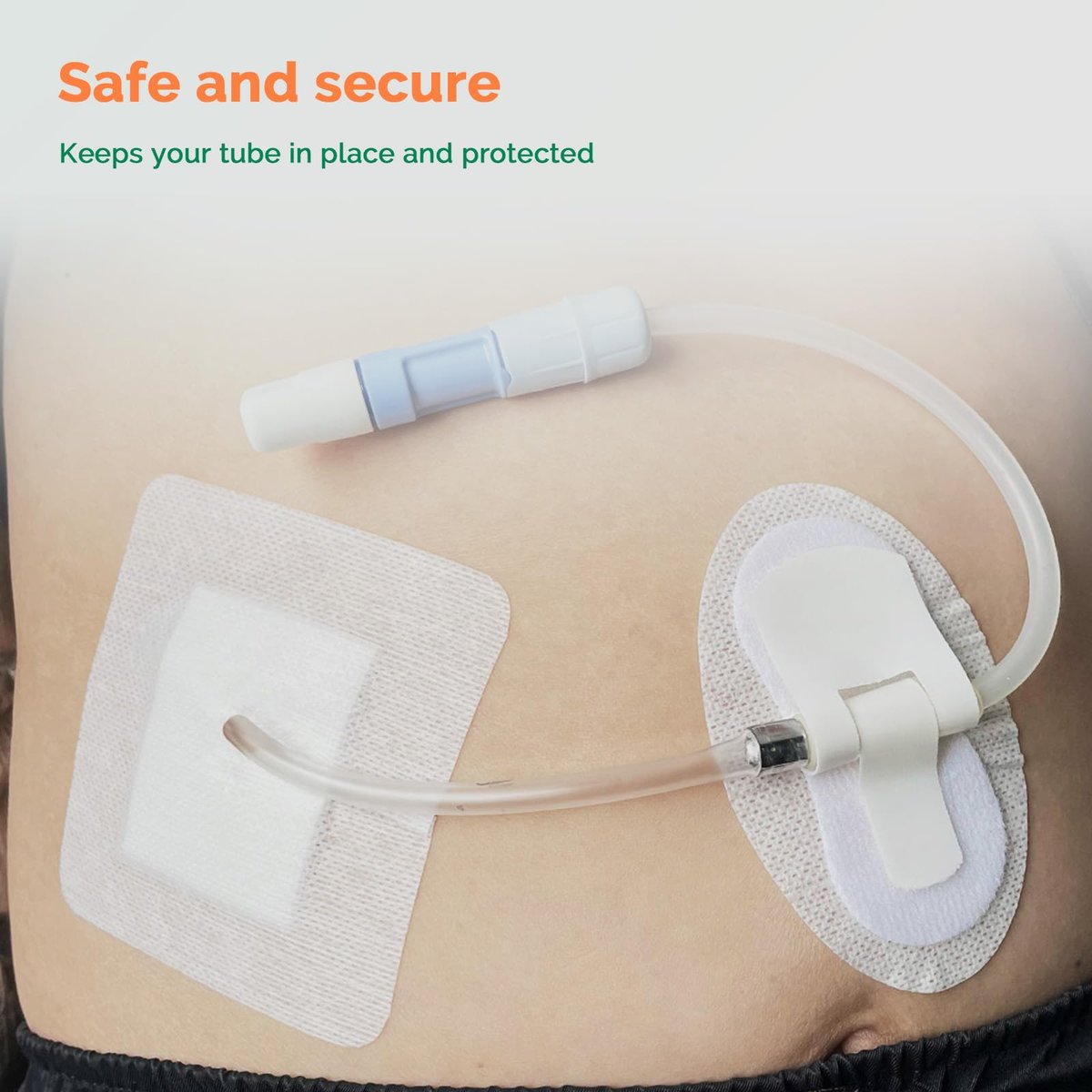Split Drain Adhesive Bandages 4" x 4" 10 Stück – PD-Katheter-Pflaster, Foley-Tubing-Stabilisierung, G-Tube-Abdeckungen, Peritonealdialyse-Zubehör