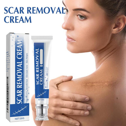 Narbencreme, Narbenentfernungscreme, Silikon-Narbengel, Narben-Silikongel, Narbengel, Narbencreme für Operationsnarben, Dehnungsstreifen und Keloid-Buckel (1 Stück)