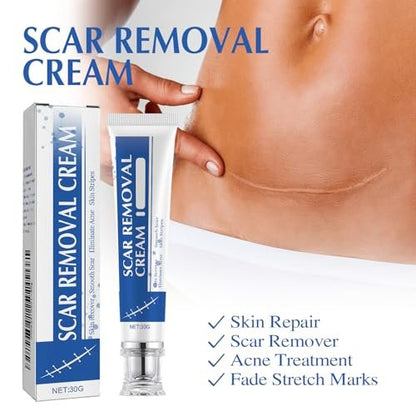 Narbencreme, Narbenentfernungscreme, Silikon-Narbengel, Narben-Silikongel, Narbengel, Narbencreme für Operationsnarben, Dehnungsstreifen und Keloid-Buckel (1 Stück)