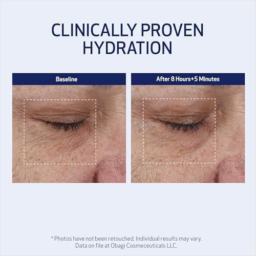 SUZANOBAGIMD Moisture Restore – Medizinische Mehrschicht-Feuchtigkeitspflege gegen Rötungen, langanhaltende Hydratation + Verbesserung von Hauttextur & Festigkeit – Für alle Hauttypen – 50 ml