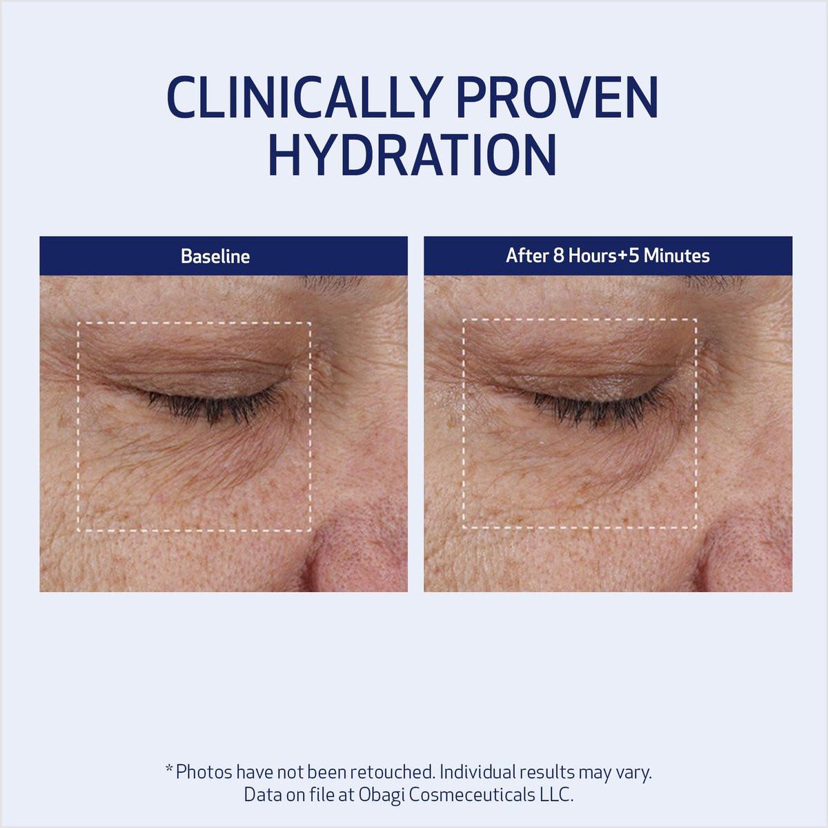 SUZANOBAGIMD Moisture Restore – Medizinische Mehrschicht-Feuchtigkeitspflege gegen Rötungen, langanhaltende Hydratation + Verbesserung von Hauttextur & Festigkeit – Für alle Hauttypen – 50 ml
