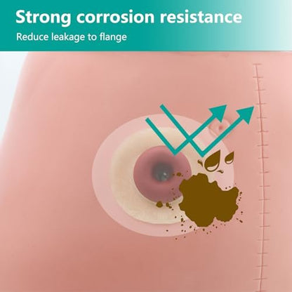 Vlookup Stoma-Barrier-Ringe – Außendurchmesser 2" (50mm), 4mm Dicke, formbare Ostomie-Ringe, Hydrokolloid-Hautschutzringe für Kolostomiebeutel, 10 Stück