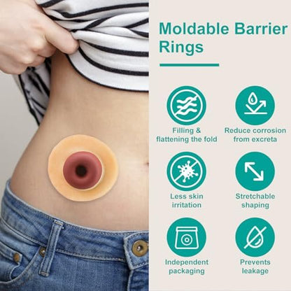 Vlookup Stoma-Barrier-Ringe – Außendurchmesser 2" (50mm), 4mm Dicke, formbare Ostomie-Ringe, Hydrokolloid-Hautschutzringe für Kolostomiebeutel, 10 Stück