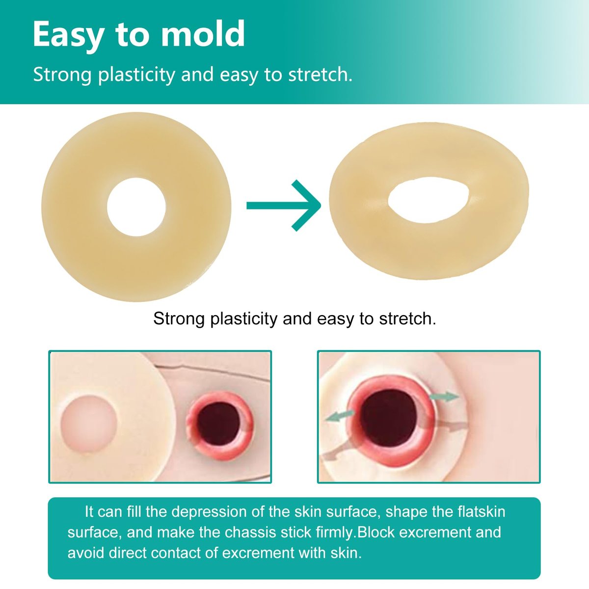 Vlookup Stoma-Barrier-Ringe – Außendurchmesser 2" (50mm), 4mm Dicke, formbare Ostomie-Ringe, Hydrokolloid-Hautschutzringe für Kolostomiebeutel, 10 Stück