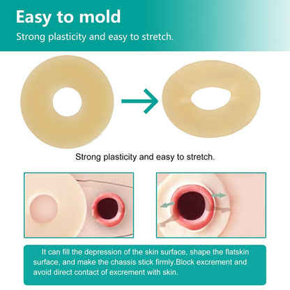 Vlookup Stoma-Barrier-Ringe – Außendurchmesser 2" (50mm), 4mm Dicke, formbare Ostomie-Ringe, Hydrokolloid-Hautschutzringe für Kolostomiebeutel, 10 Stück