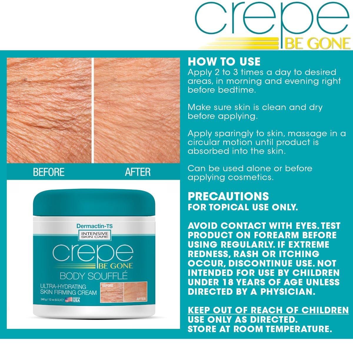 Dermactin Crepe Be Gone Body Souffle Classic – Große 12 Unzen – Ultra-feuchtigkeitsspendende Creme für crepeartige Haut an Hals, Dekolleté, Armen & Beinen