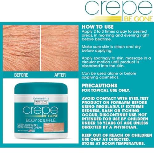 Dermactin Crepe Be Gone Body Souffle Classic – Große 12 Unzen – Ultra-feuchtigkeitsspendende Creme für crepeartige Haut an Hals, Dekolleté, Armen & Beinen