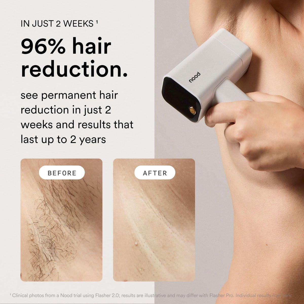 Nood™ Flasher Pro + Slow-Grow Serum – IPL-Haarentfernungsgerät für Frauen und Männer + Aftershave-Serum zur Verlangsamung des Haarwuchses, Reduzierung von eingewachsenen Haaren und Hautirritationen – Glanzweiß