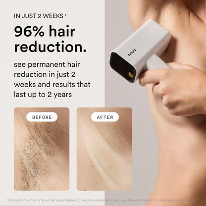 Nood™ Flasher Pro + Slow-Grow Serum – IPL-Haarentfernungsgerät für Frauen und Männer + Aftershave-Serum zur Verlangsamung des Haarwuchses, Reduzierung von eingewachsenen Haaren und Hautirritationen – Glanzweiß