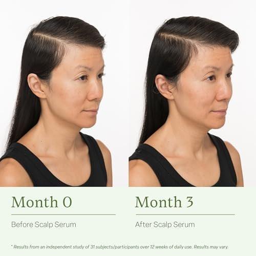 Divi Healthy Hair Goals Mini Kit – Scalp Serum, Volumizing Shampoo & Conditioner für dünner werdendes Haar (Reisegröße)