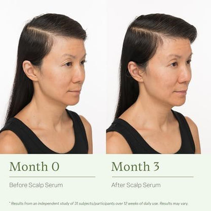 Divi Healthy Hair Goals Mini Kit – Scalp Serum, Volumizing Shampoo & Conditioner für dünner werdendes Haar (Reisegröße)