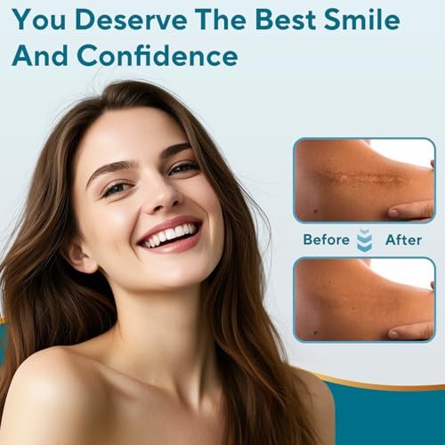 Silikon-Narbenpflaster, Silikon-Narbenband, wiederverwendbare Silikon-Narbenstreifen zur Narbenentfernung, für Operationsnarben, Keloid, Kaiserschnitt, Verbrennungen (1,6" x 118" Rolle - 3 m)
