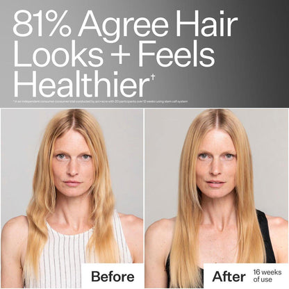 Act+Acre Stammzellen-Conditioner | Stärkt Spitzen, verleiht Glanz, hydratisiert feines Haar | Apfelstammzellen, Rizinusöl, Antioxidantien | Leicht, vegan, Cold Processed®, farbsicher | 295 ml