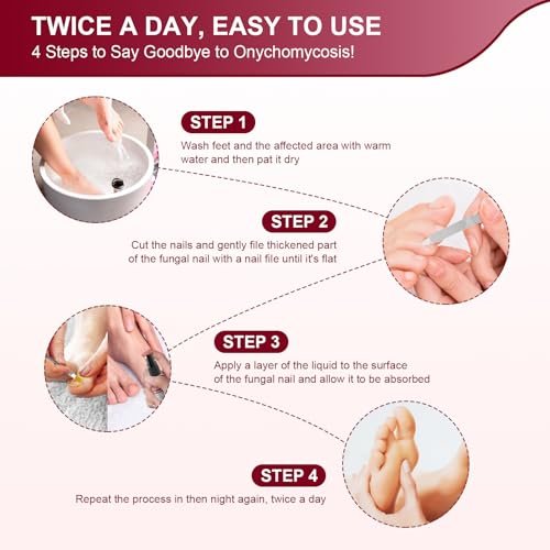 Nagelpilz Behandlung Extra Stark mit 25% Undecylensäure – 5er-Pack (5x30 ml) für beschädigte, verfärbte und verdickte Nägel