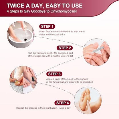 Nagelpilz Behandlung Extra Stark mit 25% Undecylensäure – 5er-Pack (5x30 ml) für beschädigte, verfärbte und verdickte Nägel