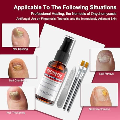 Nagelpilz Behandlung Extra Stark mit 25% Undecylensäure – 5er-Pack (5x30 ml) für beschädigte, verfärbte und verdickte Nägel