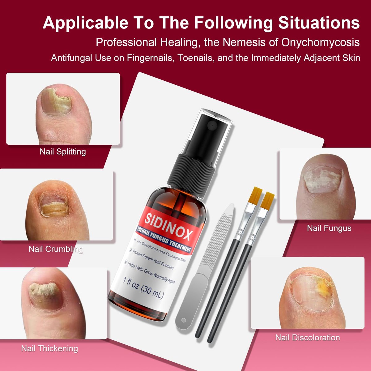 Nagelpilz Behandlung Extra Stark mit 25% Undecylensäure – 5er-Pack (5x30 ml) für beschädigte, verfärbte und verdickte Nägel