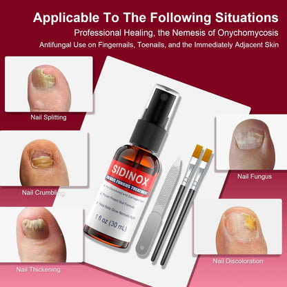 Nagelpilz Behandlung Extra Stark mit 25% Undecylensäure – 5er-Pack (5x30 ml) für beschädigte, verfärbte und verdickte Nägel