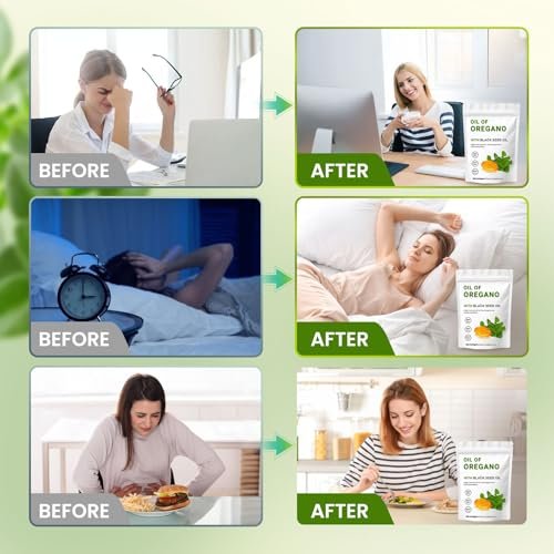 YKJHCSL 2-in-1 Oregano-Öl Softgels – Bio Oregano-Öl Kapseln mit Schwarzkümmelöl, 180 Stück