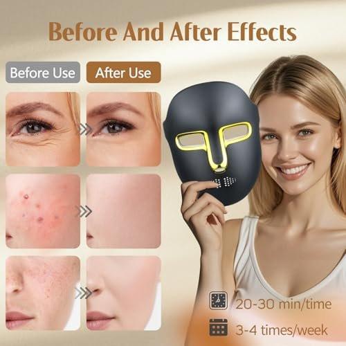 Kelyoo Rotlichttherapie-Gesichtsmaske – LED-Gesichtsmaske mit rotem und blauem LED- und Infrarotlicht, Anti-Aging- und Hautunreinheiten-Behandlung