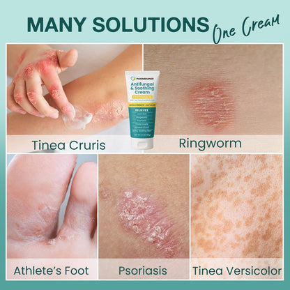 Antimykotische Creme gegen Juckreiz, Ringelflechte, Psoriasis und Fußpilz – Extra starke Linderung für juckende, brennende Haut – Schnell wirkende Formel bei Tinea cruris, Tinea versicolor und Hautirritationen