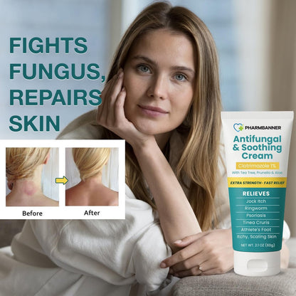 Antimykotische Creme gegen Juckreiz, Ringelflechte, Psoriasis und Fußpilz – Extra starke Linderung für juckende, brennende Haut – Schnell wirkende Formel bei Tinea cruris, Tinea versicolor und Hautirritationen