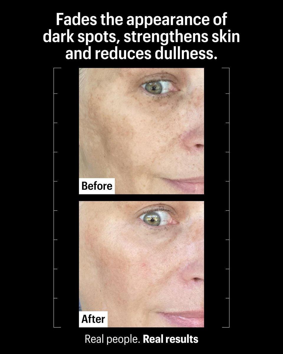 Allies of Skin Tranexamic & Arbutin Advanced Brightening Serum | Leichtes tägliches Serum mit Peptiden | 3% Tranexamsäure, belebt müde Haut | 1,6 fl oz