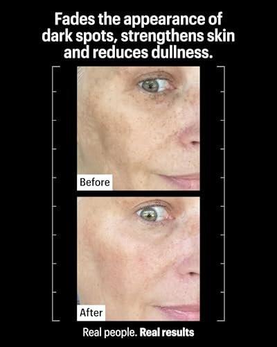 Allies of Skin Tranexamic & Arbutin Advanced Brightening Serum | Leichtes tägliches Serum mit Peptiden | 3% Tranexamsäure, belebt müde Haut | 1,6 fl oz