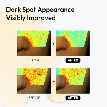 LAYERLAB 10% Vitamin C Radiance Serum mit Resveratrol & Vitamin E | Leistungsstarke Antioxidantien-Formel für einen sichtbar helleren, ebenmäßigen Teint | Feuchtigkeitsspendende K-Beauty Hautpflege (0,94 fl oz)