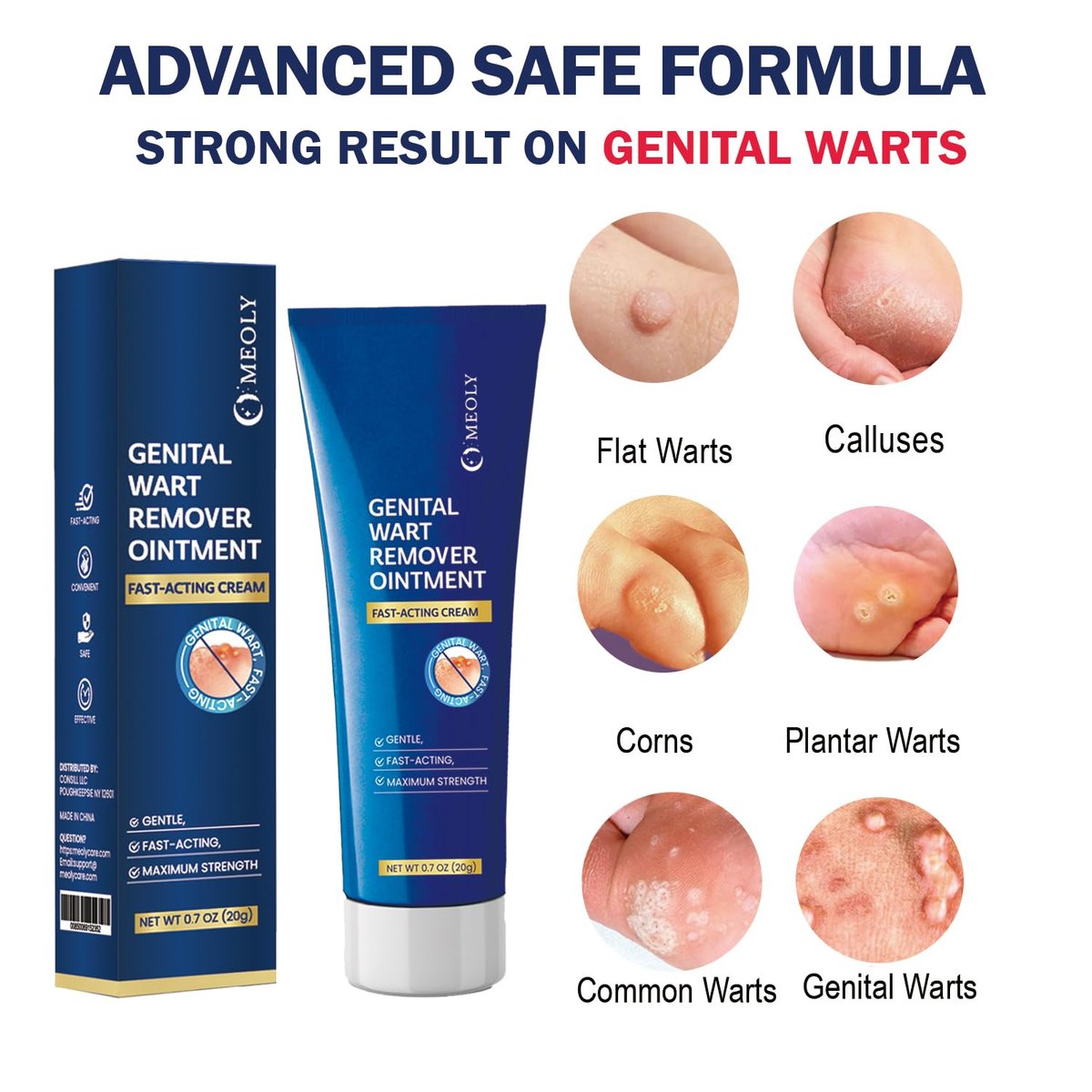 MEOLY Genital Warzen Entferner Creme – Schnell wirkende Salicylsäure Creme für Männer und Frauen
