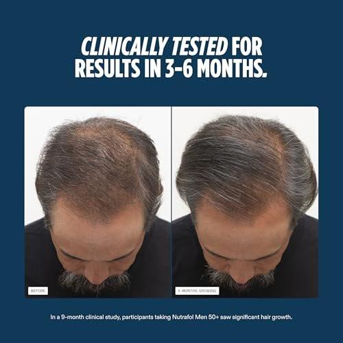 Nutrafol Men 50+ Haarwachstums-Ergänzungsmittel, klinisch getestet für sichtbar dichteres Haar und Kopfhautabdeckung, #1 von Dermatologen empfohlen - 1-Monats-Vorrat, 1 Nachfüllbeutel