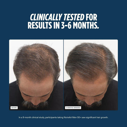 Nutrafol Men 50+ Haarwachstums-Ergänzungsmittel, klinisch getestet für sichtbar dichteres Haar und Kopfhautabdeckung, #1 von Dermatologen empfohlen - 1-Monats-Vorrat, 1 Nachfüllbeutel