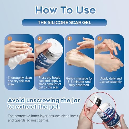 Glowor Silikon-Gel für Narben – Fortschrittliche Narbencreme für Gesicht & Körper – Reduziert das Erscheinungsbild von alten & neuen Narben, Aknenarben, Operationsnarben, Verbrennungen, Verletzungen, Kaiserschnittnarben – 100 g