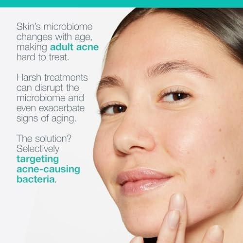 Dermalogica Acne Biotic Feuchtigkeitscreme – Leichte Tageslotion gegen Hautalterung und Unreinheiten, 50 ml