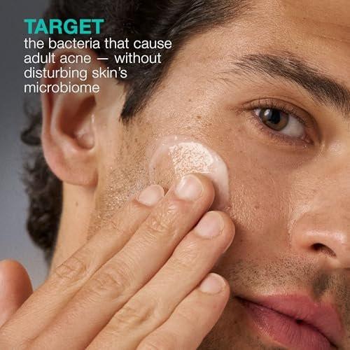 Dermalogica Acne Biotic Feuchtigkeitscreme – Leichte Tageslotion gegen Hautalterung und Unreinheiten, 50 ml