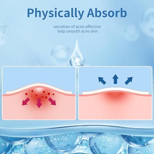 Daolyo Pimple Patches für das Gesicht - 3 Größen, 510 Stück Hydrokolloid-Akne-Pflaster zur Abdeckung von Pickeln und Unreinheiten, Spot-Sticker mit Salicylsäure, Teebaumöl und Ringelblumenöl (8 mm, 10 mm, 12 mm)