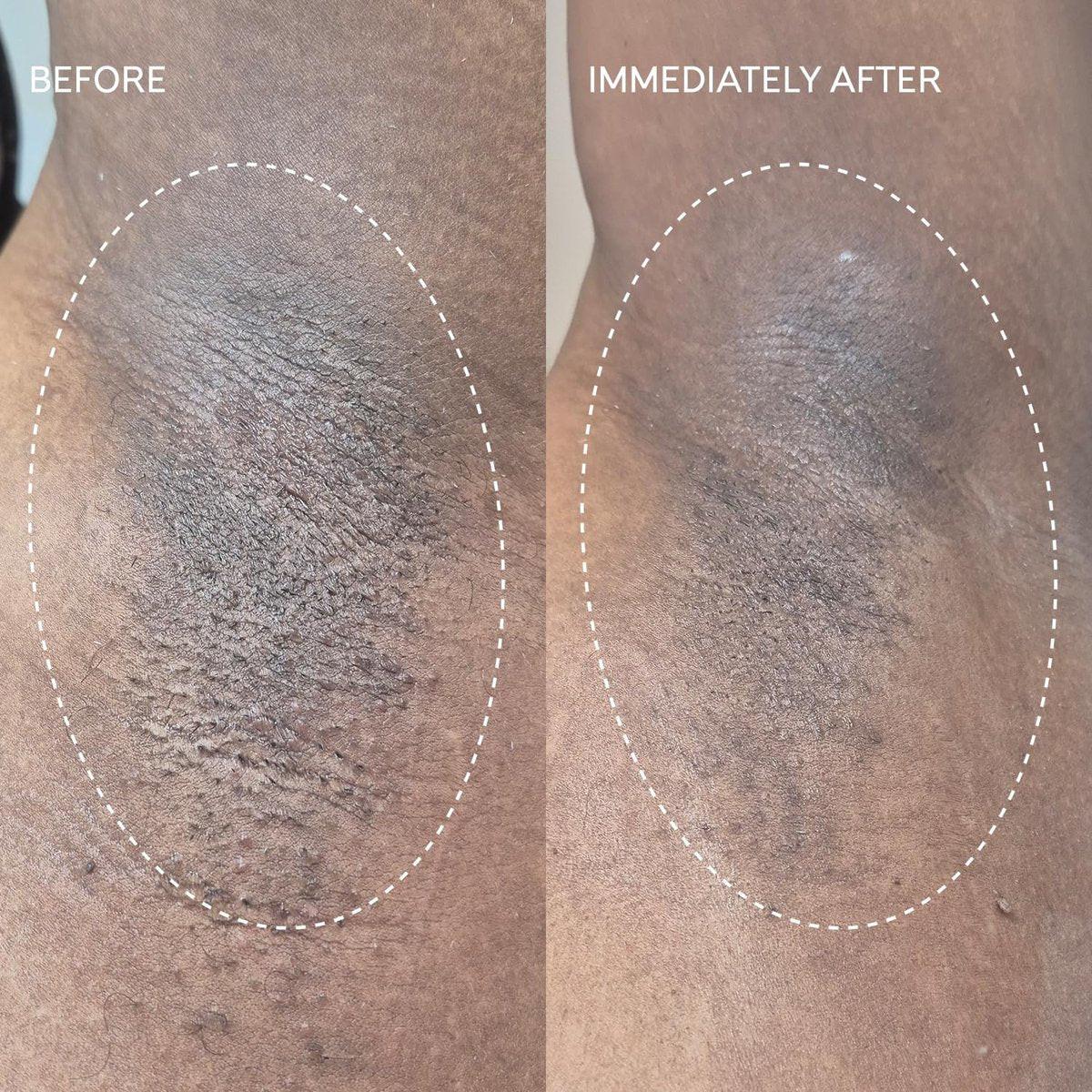Fur Flash Repair Jelly – Hypochlorige Säure Aftercare Gel für die Zeit nach Waxing, Rasur oder Laser – Beruhigt Rötungen, Pickel und Irritationen – Dermatologisch getestet, parfümfrei (60 ml)