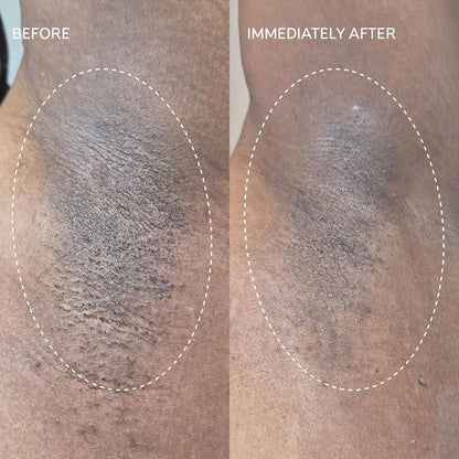 Fur Flash Repair Jelly – Hypochlorige Säure Aftercare Gel für die Zeit nach Waxing, Rasur oder Laser – Beruhigt Rötungen, Pickel und Irritationen – Dermatologisch getestet, parfümfrei (60 ml)