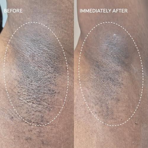 Fur Flash Repair Jelly – Hypochlorige Säure Aftercare Gel für die Zeit nach Waxing, Rasur oder Laser – Beruhigt Rötungen, Pickel und Irritationen – Dermatologisch getestet, parfümfrei (60 ml)