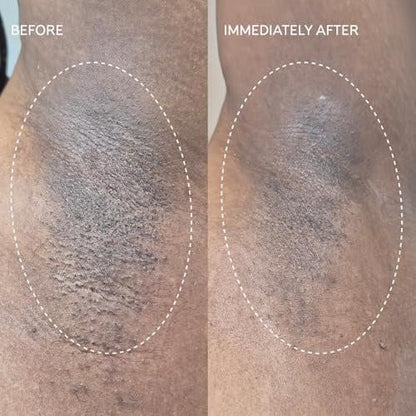 Fur Flash Repair Jelly – Hypochlorige Säure Aftercare Gel für die Zeit nach Waxing, Rasur oder Laser – Beruhigt Rötungen, Pickel und Irritationen – Dermatologisch getestet, parfümfrei (60 ml)