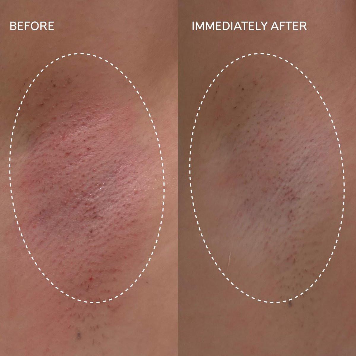 Fur Flash Repair Jelly – Hypochlorige Säure Aftercare Gel für die Zeit nach Waxing, Rasur oder Laser – Beruhigt Rötungen, Pickel und Irritationen – Dermatologisch getestet, parfümfrei (60 ml)