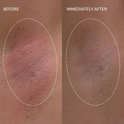 Fur Flash Repair Jelly – Hypochlorige Säure Aftercare Gel für die Zeit nach Waxing, Rasur oder Laser – Beruhigt Rötungen, Pickel und Irritationen – Dermatologisch getestet, parfümfrei (60 ml)